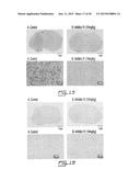 SALICYCLIC ACID DERIVATIVES, PHARMACEUTICALLY ACCEPTABLE SALT THEREOF,     COMPOSITION THEREOF AND METHOD OF USE THEREOF diagram and image