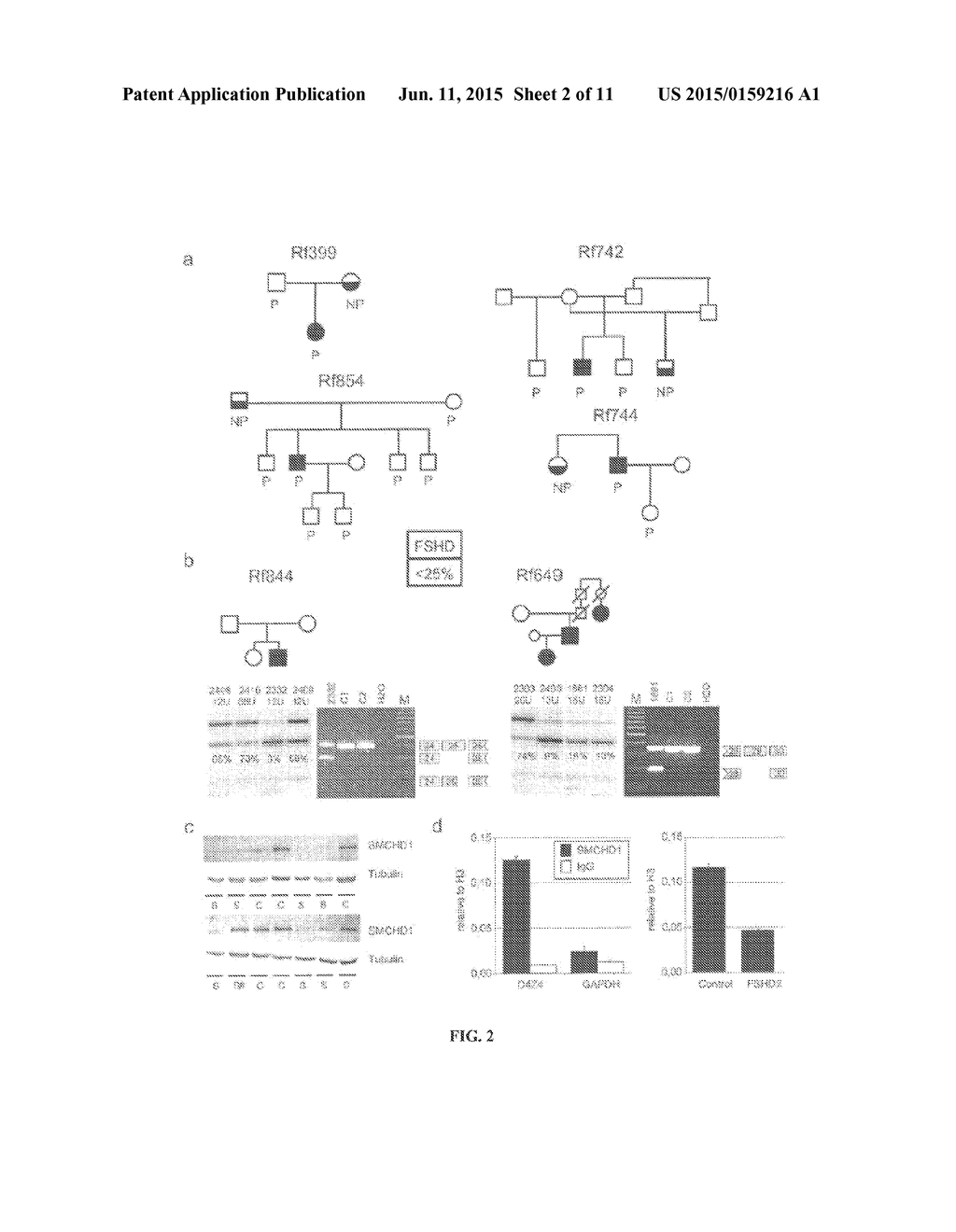 METHODS AND COMPOSITIONS RELATED TO THE SMCHD1 GENE - diagram, schematic, and image 03