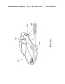 VIBRATION ELEMENT, VIBRATOR, VIBRATION DEVICE, ELECTRONIC DEVICE AND     MOVING OBJECT diagram and image