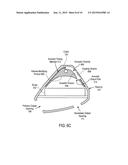 EARPHONE HAVING A CONTROLLED ACOUSTIC LEAK PORT diagram and image