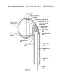 EARPHONE HAVING A CONTROLLED ACOUSTIC LEAK PORT diagram and image