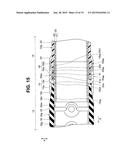 ENDOSCOPE diagram and image