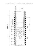 ENDOSCOPE diagram and image