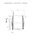 ENDOSCOPE diagram and image