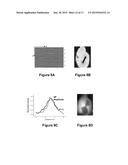 Systems and Methods for Visualizing Ablated Tissue diagram and image