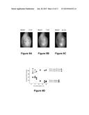 Systems and Methods for Visualizing Ablated Tissue diagram and image