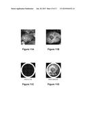 Systems and Methods for Visualizing Ablated Tissue diagram and image