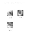 Systems and Methods for Visualizing Ablated Tissue diagram and image