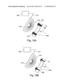 INTELLIGENT IMPLANTED HEALTH SENSING DEVICE AND ASSEMBLY diagram and image