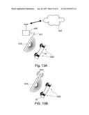 INTELLIGENT IMPLANTED HEALTH SENSING DEVICE AND ASSEMBLY diagram and image