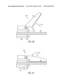 ULTRASONIC AND ELECTROSURGICAL DEVICES diagram and image