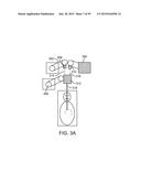 ENDOSCOPIC DEVICE WITH DOUBLE-HELICAL LUMEN DESIGN diagram and image