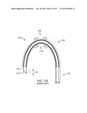 ENDOSCOPIC DEVICE WITH DOUBLE-HELICAL LUMEN DESIGN diagram and image