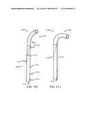 ENDOSCOPIC DEVICE WITH DOUBLE-HELICAL LUMEN DESIGN diagram and image