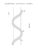 ENDOSCOPIC DEVICE WITH DOUBLE-HELICAL LUMEN DESIGN diagram and image