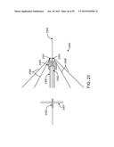 ENDOSCOPIC DEVICE WITH DOUBLE-HELICAL LUMEN DESIGN diagram and image