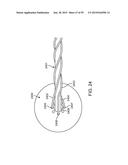 ENDOSCOPIC DEVICE WITH DOUBLE-HELICAL LUMEN DESIGN diagram and image