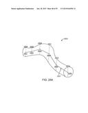 ENDOSCOPIC DEVICE WITH DOUBLE-HELICAL LUMEN DESIGN diagram and image