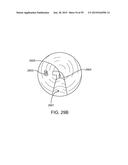 ENDOSCOPIC DEVICE WITH DOUBLE-HELICAL LUMEN DESIGN diagram and image
