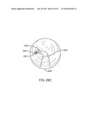 ENDOSCOPIC DEVICE WITH DOUBLE-HELICAL LUMEN DESIGN diagram and image