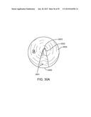 ENDOSCOPIC DEVICE WITH DOUBLE-HELICAL LUMEN DESIGN diagram and image