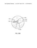 ENDOSCOPIC DEVICE WITH DOUBLE-HELICAL LUMEN DESIGN diagram and image