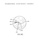 ENDOSCOPIC DEVICE WITH DOUBLE-HELICAL LUMEN DESIGN diagram and image