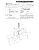 METHODS FOR FACET JOINT TREATMENT diagram and image