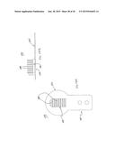 METHODS FOR FACET JOINT TREATMENT diagram and image