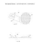 METHODS FOR FACET JOINT TREATMENT diagram and image