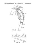 ADVANCED ENDOVASCULAR GRAFT AND DELIVERY SYSTEM diagram and image