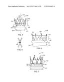 ADVANCED ENDOVASCULAR GRAFT AND DELIVERY SYSTEM diagram and image