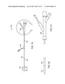 ADVANCED ENDOVASCULAR GRAFT AND DELIVERY SYSTEM diagram and image