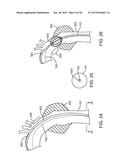 ADVANCED ENDOVASCULAR GRAFT AND DELIVERY SYSTEM diagram and image