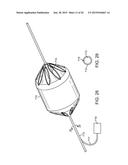 ADVANCED ENDOVASCULAR GRAFT AND DELIVERY SYSTEM diagram and image