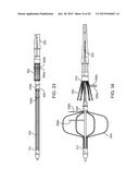 ADVANCED ENDOVASCULAR GRAFT AND DELIVERY SYSTEM diagram and image