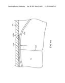 ADVANCED ENDOVASCULAR GRAFT AND DELIVERY SYSTEM diagram and image