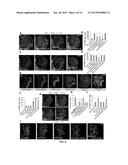 TARGETING A NON-CANONICAL NOTCH SIGNALING PATHWAY FOR CANCER TREATMENT diagram and image