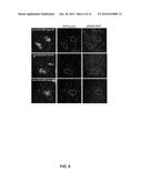 TARGETING A NON-CANONICAL NOTCH SIGNALING PATHWAY FOR CANCER TREATMENT diagram and image