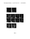 TARGETING A NON-CANONICAL NOTCH SIGNALING PATHWAY FOR CANCER TREATMENT diagram and image