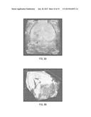 CONTRAST IMAGING APPLICATIONS FOR LANTHANIDE NANOPARTICLES diagram and image