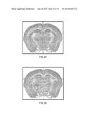 CONTRAST IMAGING APPLICATIONS FOR LANTHANIDE NANOPARTICLES diagram and image