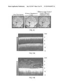 CONTRAST IMAGING APPLICATIONS FOR LANTHANIDE NANOPARTICLES diagram and image