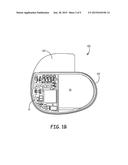 IMPLANTABLE MEDICAL DEVICE CONSTRUCTION diagram and image