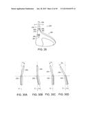 INTERCHANGEABLE SHAFT SYSTEM diagram and image