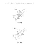 INTERCHANGEABLE SHAFT SYSTEM diagram and image