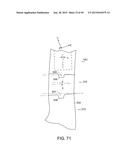 INTERCHANGEABLE SHAFT SYSTEM diagram and image