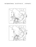 HINGED HANDGRIP PAD diagram and image