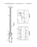 TURBINE ENGINE COMPRISING AN UPSTREAM ATTACHMENT MEANS FOR A DEOILING PIPE diagram and image