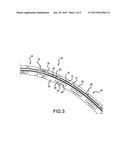 BIDIRECTIONAL LIFT-OFF CIRCUMFERENTIAL SHAFT SEAL SEGMENT AND A SHAFT SEAL     INCLUDING A PLURALITY OF THE SEGMENTS diagram and image